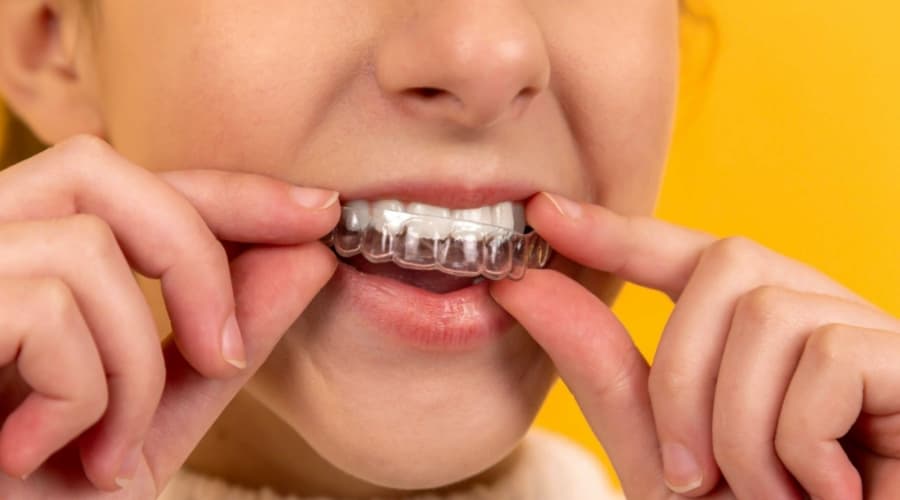 Aligner detalle