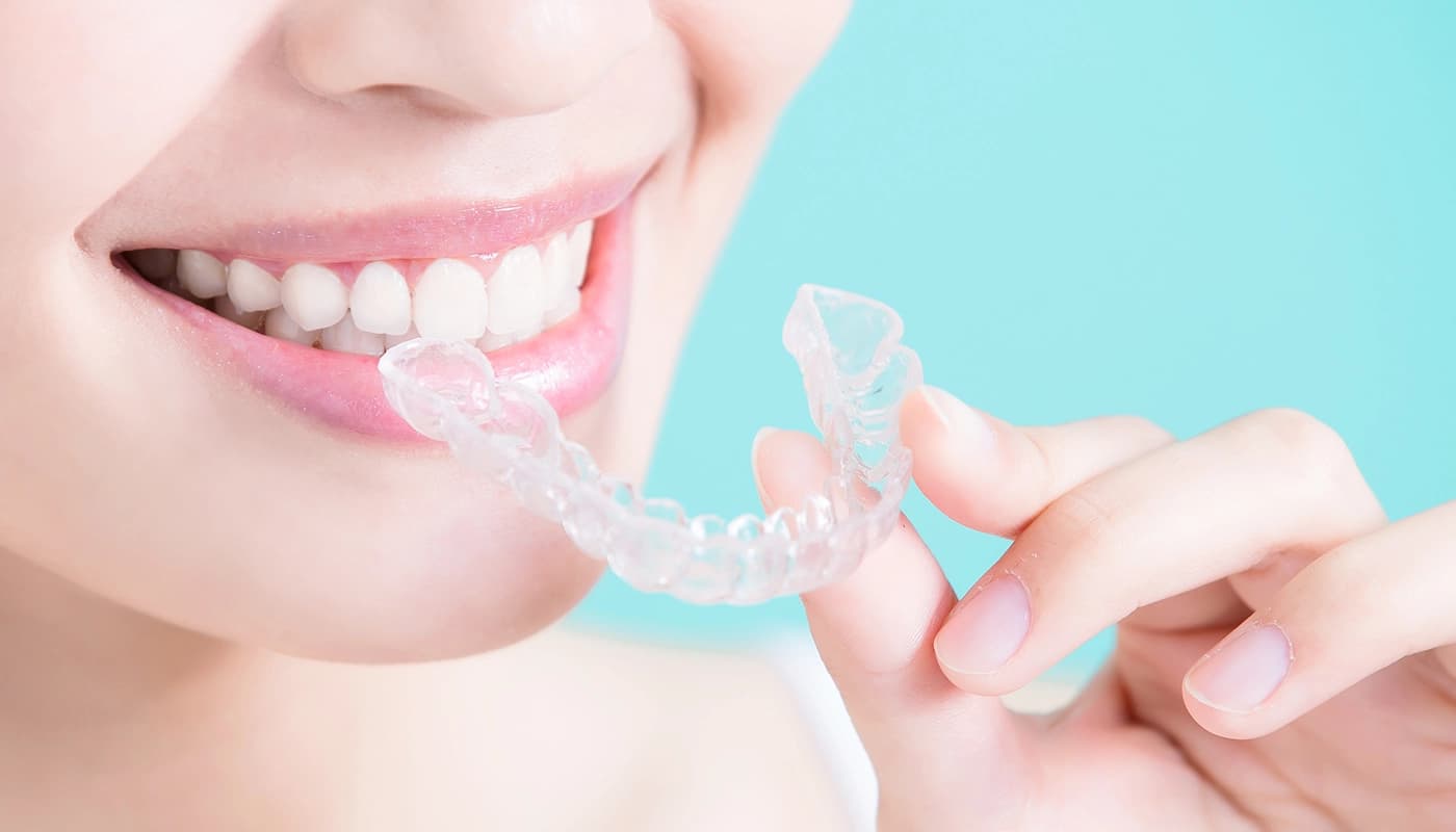 Aligner 3